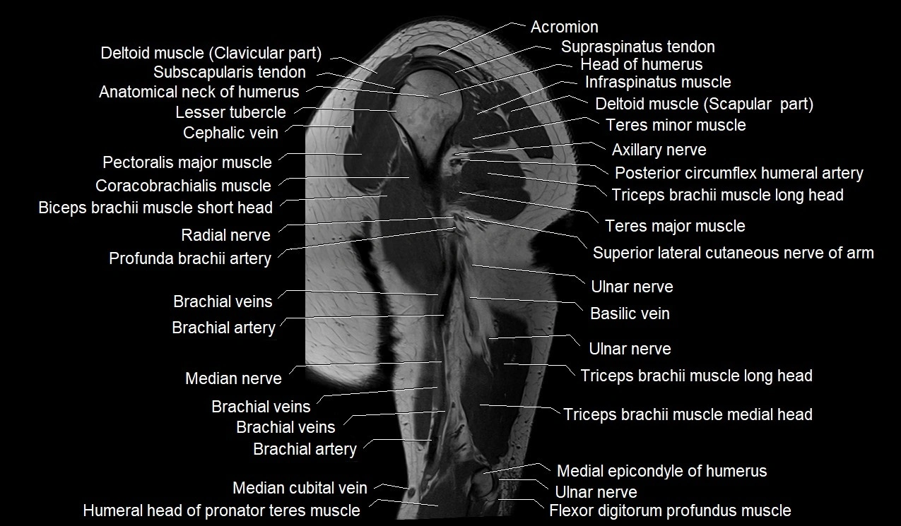 Upper arm (humerus ) saittal cross sectional anatomy 3T image 21.webp